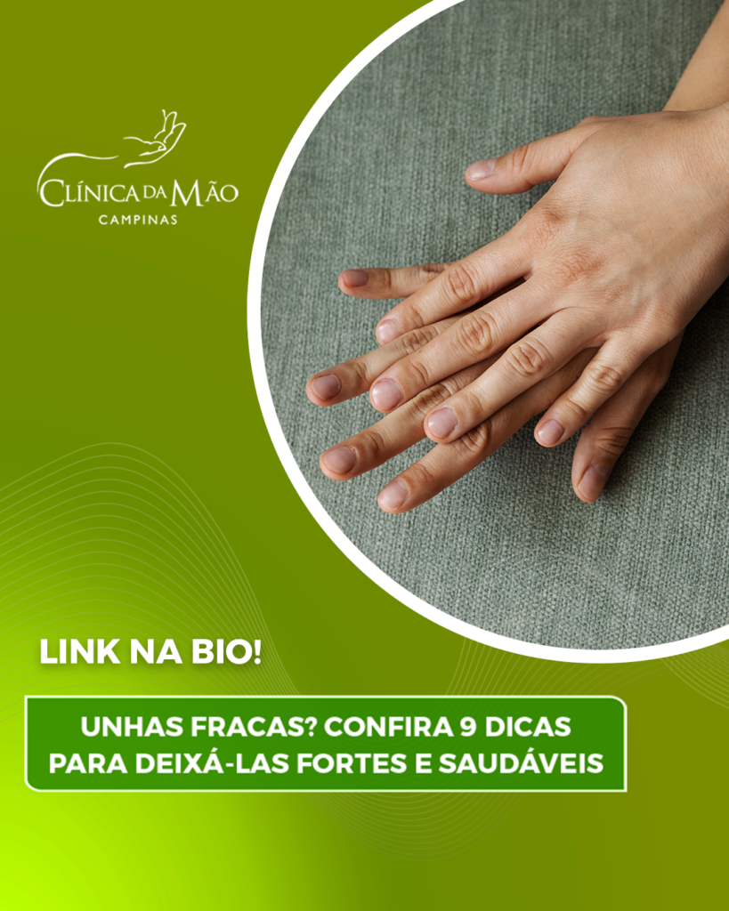 unhas formato amendoado