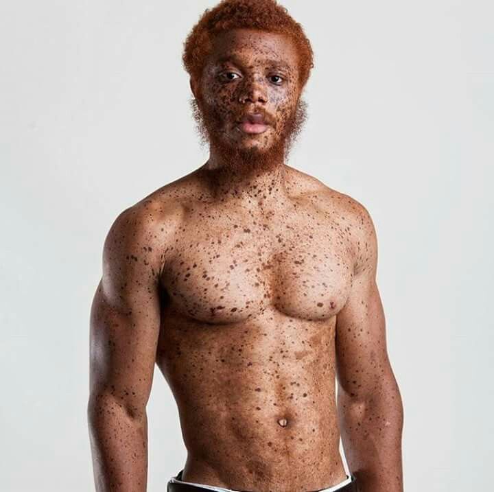 cabelo ruivo em pele negra
