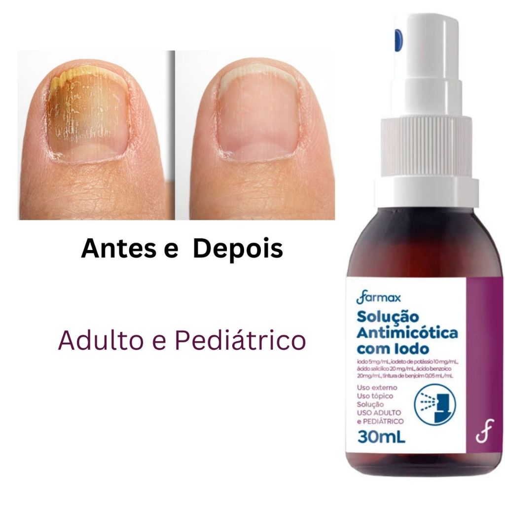 unhas descamando causas e tratamento