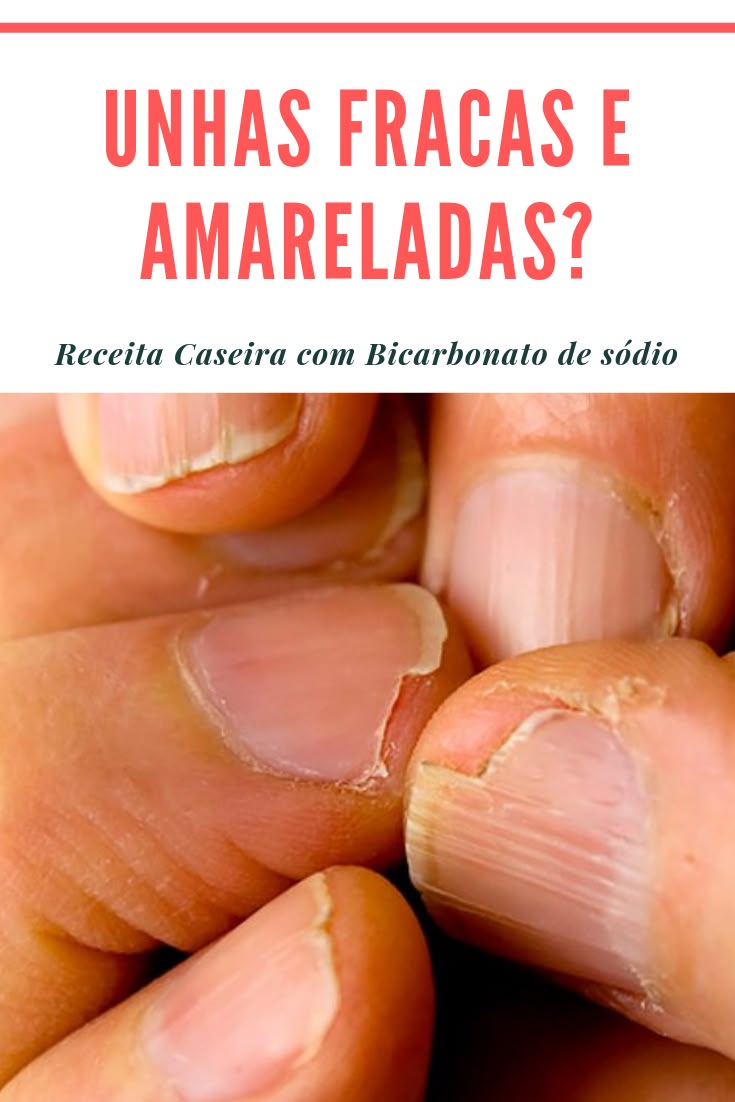como fortalecer unhas rapidamente