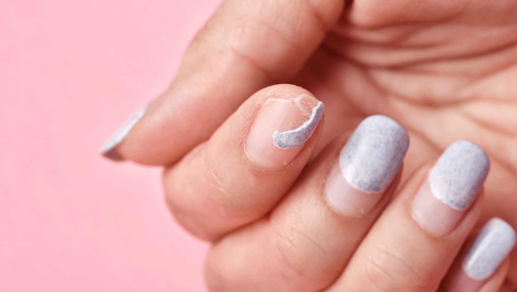 unhas fracas tratamento natural