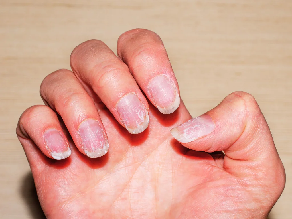 como fortalecer unhas rapidamente