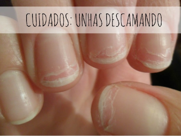 fortalecer unhas com alho