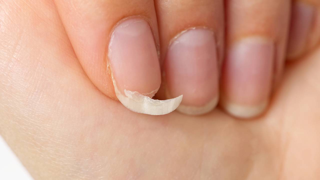óleo para unhas fracas caseiro