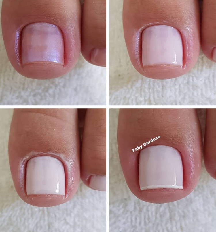 unhas do pé saudáveis